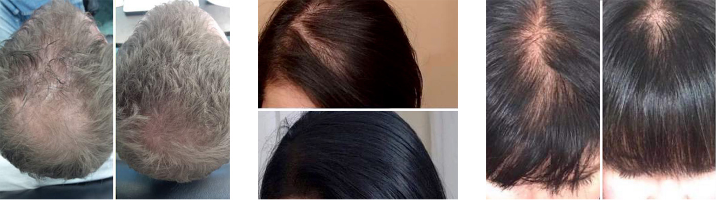 Before and after comparison photos